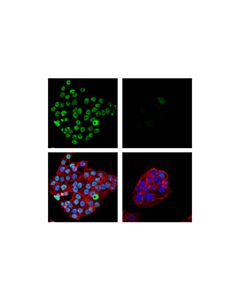 Cell Signaling 53bp1 (E7n5d) Xp Rabbit mAb