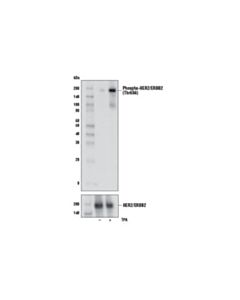 Cell Signaling Phospho-Her2/Erbb2 (Thr686) Antibody