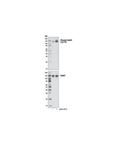 Cell Signaling Phospho-Epha3 (Tyr779) (D10h1) Rabbit mAb