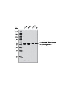 Cell Signaling Glucose-6-Phosphate Dehydrogenase Antibody