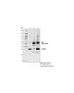 Cell Signaling Steap1 (D8b2v) Rabbit mAb