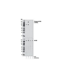 Cell Signaling Phospho-AS160 (Thr642) (D27E6) Rabbit mAb 20 uL