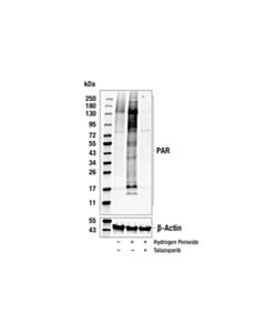 Cell Signaling Poly/Mono-ADP Ribose (D9P7Z) Rabbit mAb