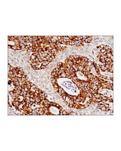Cell Signaling Slp-2 (D2i9x) Xp Rabbit mAb
