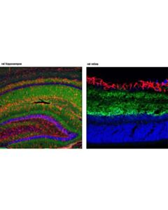 Cell Signaling Gap43 (D9c8) Rabbit mAb