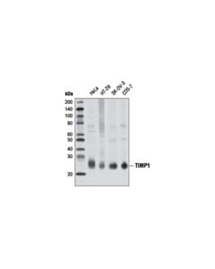 Cell Signaling Timp1 (D10e6) Rabbit mAb