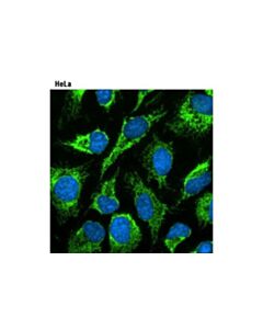 Cell Signaling Prolong<LT/>Sup&Gt;® <LT/>/Sup&Gt;Gold Antifade Reagent With Dapi