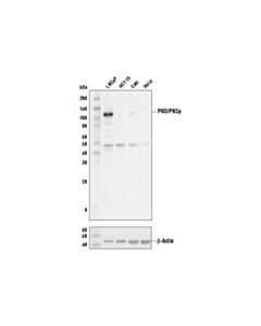 Cell Signaling Pkd/Pkcmu (D4j1n) Rabbit mAb