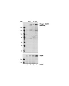 Cell Signaling Phospho-Brca1 (Ser1524) Antibody