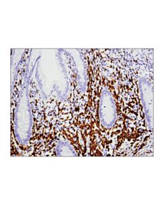Cell Signaling Ncam-L1 (D5d3k) Rabbit mAb