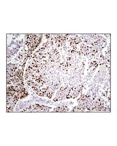 Cell Signaling Ki-67 (D2h10) Rabbit mAb (Ihc Specific)