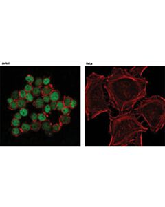 Cell Signaling Ikaros (D10e5) Rabbit mAb