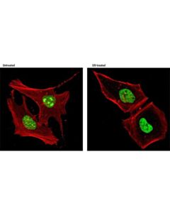 Cell Signaling Rad18 (D2b8) Xp Rabbit mAb