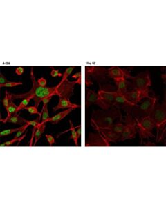 Cell Signaling Pias3 (D5f9) Xp Rabbit mAb