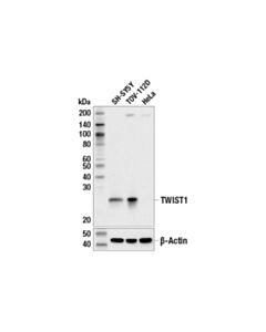 Cell Signaling Twist1 (E5g9y) Rabbit mAb