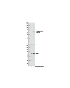 Cell Signaling Phospho-Plk1 (Thr210) (D5h7) Rabbit mAb