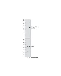 Cell Signaling Phospho-PLK1 (Thr210) (D5H7) Rabbit mAb 20 uL