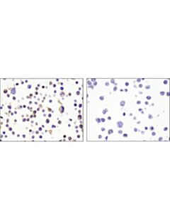 Cell Signaling Cxcr4 (D4z7w) Rabbit mAb (Ihc Specific) (BSA And Azide Free)