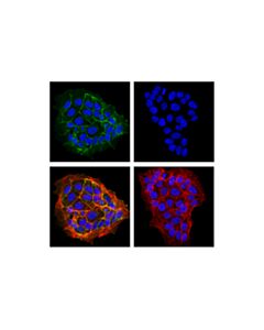 Cell Signaling Occludin (E6b4r) Rabbit mAb