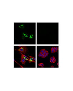 Cell Signaling Col1a1 (E8i9z) Rabbit mAb