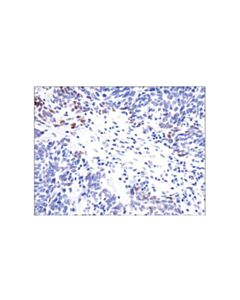 Cell Signaling Phospho-Stat3 (Tyr705) (D3a7) Xp Rabbit mAb