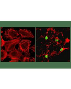 Cell Signaling Cleaved PARP (Asp214) (D64E10) XP® Rabbit mAb (Alexa Fluor® 488 Conjugate); 20 µl