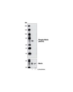 Cell Signaling Phospho-Merlin (Ser518) Antibody