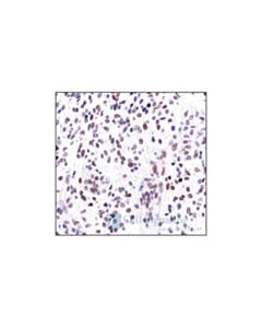 Cell Signaling C-Jun (60a8) Rabbit mAb