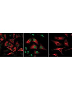 Cell Signaling Phospho-Stat1 (Ser727) Antibody