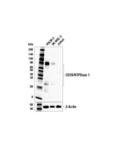 Cell Signaling CD39/NTPDase 1 (E5A6L) Rabbit mAb 20 uL