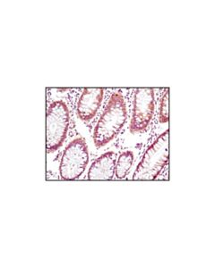 Cell Signaling Pten (D4.3) Xp Rabbit mAb