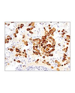Cell Signaling Cd206/Mrc1 (E2l9n) Rabbit