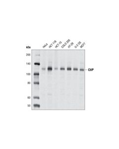 Cell Signaling Ctip (D76f7) Rabbit mAb