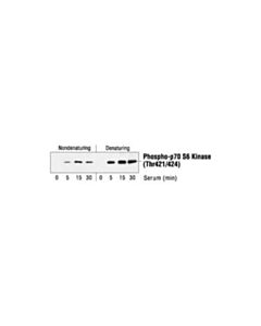Cell Signaling Phospho-P70 S6 Kinase (Thr421/Ser424) Antibody