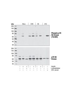 Cell Signaling Phospho-P70 S6 Kinase (Thr389) Antibody