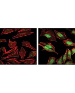 Cell Signaling Phospho-P38 Mapk (Thr180/Tyr182) Antibody