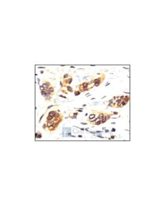 Cell Signaling P38 Mapk Antibody