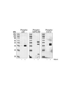 Cell Signaling Phospho-p38 MAPK (Thr180/Tyr182) (3D7) Rabbit mAb 20 uL