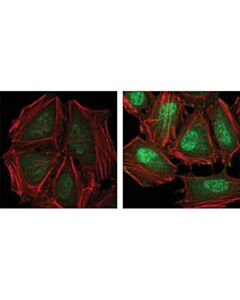 Cell Signaling Phospho-P38 Mapk (Thr180/Tyr182) (28b10) Mouse mAb