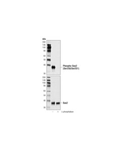 Cell Signaling Phospho-Sox2 (Ser250/Ser251) (A2I7G) Rabbit mAb 20 uL