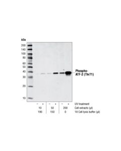 Cell Signaling Phospho-p38 MAPK (Thr180/Tyr182) (28B10) Mouse mAb (Sepharose Bead Conjugate) 400 uL