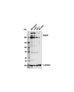 Cell Signaling Tasor (E6m2y) Rabbit mAb