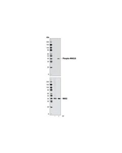 Cell Signaling Mkk3/Mkk6 Control Cell Extracts