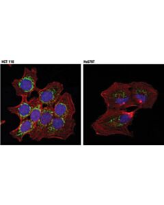 Cell Signaling Trap1/Hsp75 (D3d7n) Rabbit mAb