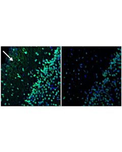 Cell Signaling Trueblack ® Lipofuscin Autofluorescence Quencher