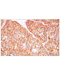 Cell Signaling Jam-A (E8d2n) Xp® Rabbit mAb