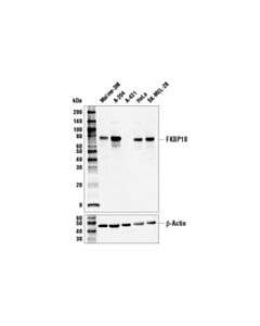 Cell Signaling Fkbp10 Antibody