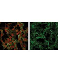 Cell Signaling Akt Antibody