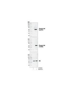 Cell Signaling Akt Control Cell Extracts
