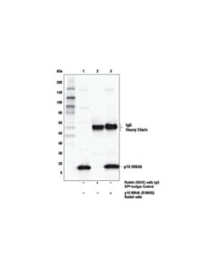 Cell Signaling P16 Ink4a (D3w8g) Rabbit mAb